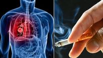 Lung Cancer: स्मोक न करने वालों को भी हो रहा लंग कैंसर, जानें इसके कारण, लक्षण और बचाव के उपाय