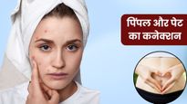 चेहरे पर पिंपल्स होने का पेट से क्या कनेक्शन है? जानिए क्या कहता है आयुर्वेद