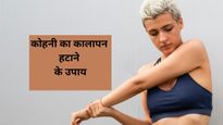 काली कोहनी को गोरा करने के 2 आसान घरेलू उपाय, एक ही बार में दूर हो जाएगा जिद्दी कालापन