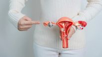 PCOS का नाम बदलकर हुआ PMOS, जानिए क्या है इसका मतलब और क्यों रखा नया नाम