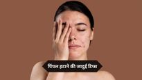 रातभर में गायब हो जाएंगे चेहरे के जिद्दी व भद्दे पिंपल्स, बस आजमा कर देखें ये 7 जादुई टिप्स