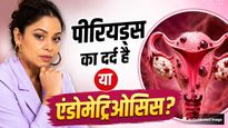 सुमोना चक्रवर्ती की हुई एंडोमेट्रियोसिस सर्जरी, 2 महीने से दर्द में थीं; जानें इस गंभीर बीमारी के 7 लक्षण