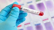 दिल्ली में बढ़े H1N1 (स्वाइन फ्लू) के मामले, अब तक 1344 केस, ये लक्षण दिखें तो बिल्कुल नजरअंदाज न करें