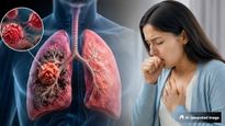 World Lung Cancer Day 2026: स्मोकिंग न करने वालों को भी हो सकता है लंग कैंसर, जानें इसके कारण, लक्षण और बचाव