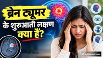 बार-बार होने वाला सिरदर्द कहीं ब्रेन ट्यूमर तो नहीं? डॉक्टर ने बताए 5 वार्निंग संकेत जिन्हें पहचानना है जरूरी