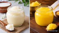 White Ghee Vs Yellow Ghee: सफेद या पीला घी, सेहत के लिए क्या है ज्यादा फायदेमंद? जानिए डायटीशियन की राय