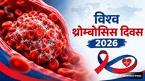 विश्व थ्रोम्बोसिस दिवस 2026: जानें इतिहास, महत्व और ब्लड क्लॉट्स से बचने के आसान टिप्स