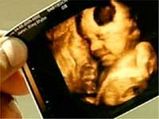 Jesus Appears In Ultrasound Scan