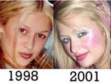 Paris Hilton On Plastic Surgery