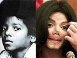 MJ Underwent Sperm Count Boost Operation, Why?