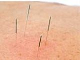 Acupuncture Provides No Help In IVF