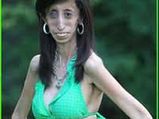 The 15 Minute Eater -  Lizzie Velasquez