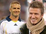 Celebs Who Went For Hair Transplants 