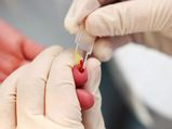 Do You Belong To A Rare Blood Group? 
