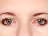 10 Home Remedies For Itchy Eyes
