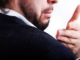 What Causes Dandruff?