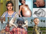 10 Strange Medical Cases Reported In India