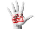 8 Symptoms Of Cervical Cancer