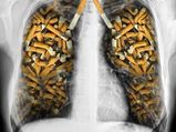 Simple Ways Smokers Can Purify Their Lungs