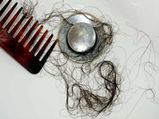 Alarming Signs Your Hair Is Falling Out