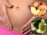 DIY Potato And Castor Oil Skin Pack To Reduce Stretch Marks 