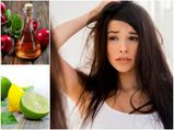 These Are The Perfect Herbal Remedies For Dandruff Cure