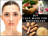 DIY Sandalwood Powder And Rose Water Mask To Get Rid Of Whiteheads