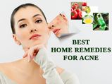9 Incredible Home Remedies For Acne That Actually Work