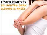 Tested Remedies To Lighten Dark Elbows & Knees