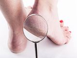 Take Notice Of These Foot Problems