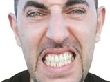 If You Are Stressed, Your Teeth Will Also Suffer; So Handle This Problem With Care