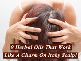 9 Herbal Oils That Work Like A Charm On Itchy Scalp!