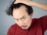 Surprising Reasons For Hair Loss In Men!