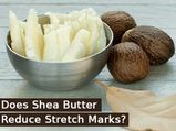Does Shea Butter Reduce Stretch Marks?