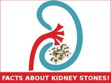 7 Surprising Facts You Must Know About Kidney Stones! 