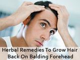 Herbal Remedies To Grow Hair Back On Balding Forehead