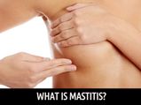 How To Get Rid Of Mastitis During Breastfeeding
