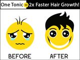 Apply This 1 Tonic Before Hair Wash & Make Your Hair Grow 2x Faster! Try It!