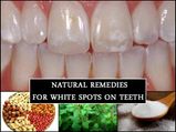 Do You Have White Spots On Your Teeth? These Natural Remedies Help Get Rid Of It 