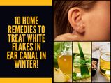 10 Home Remedies To Treat White Flakes In Ear Canal In Winter!