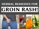 Herbal Remedies For Groin Rash!