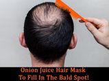 Onion Juice Hair Mask To Fill In The Bald Spot!