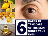 6 Hacks To Take Care Of The Skin Under Your Eyes!