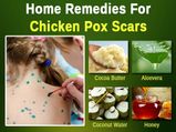 Home Remedies To Get Rid Of Chicken Pox Scars