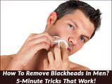 How To Remove Blackheads In Men? 5-Minute Tricks That Work!