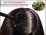 How To Use Rosemary To Permanently Remove Dandruff?