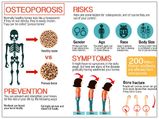 Serious Facts About Osteoporosis