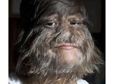 List Of Incredibly Hairy People