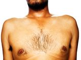 Here Are Reasons Why Your Body Hair Is Thinning