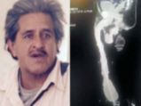 WHATT! This Man Has The World's Largest Penis!